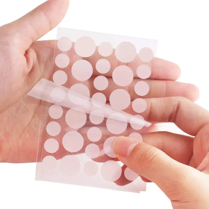 AcnePatch Skin Clear – ¡Parches para el control de acné y espinillas!