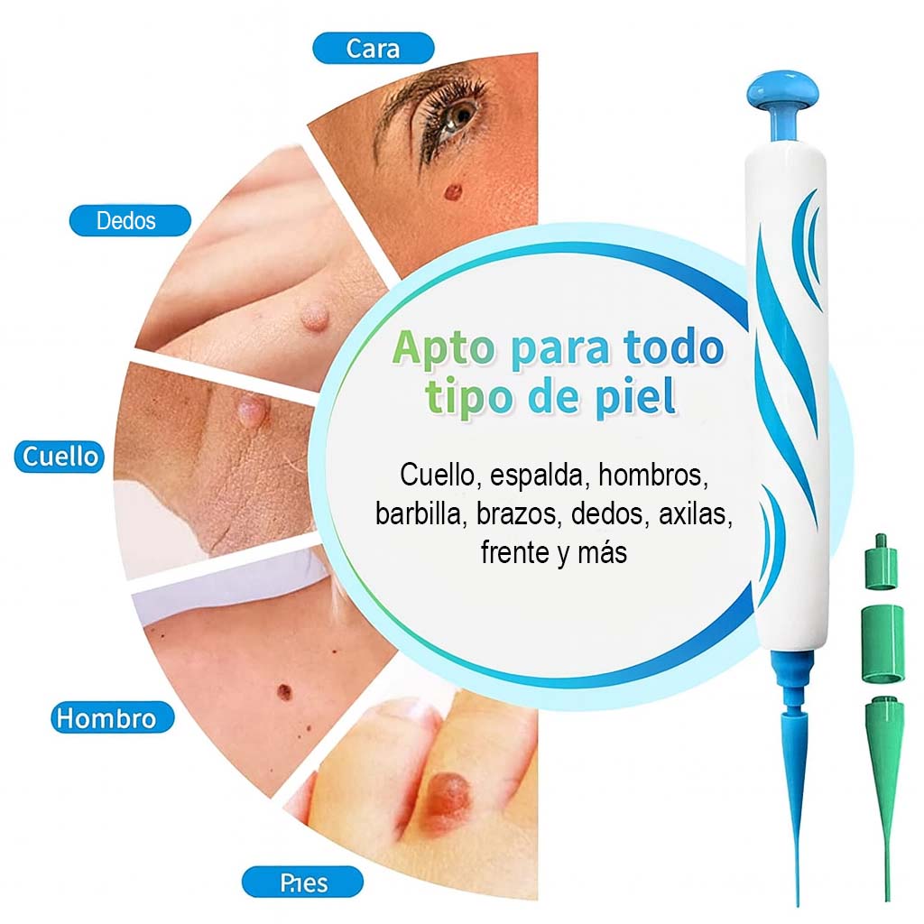 SkinClearTagPro - Kit para remover verrugas